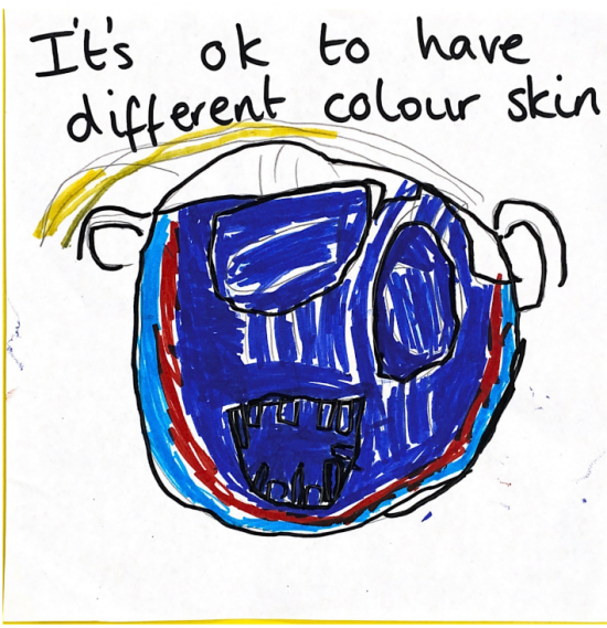 It's ok to have different colour skin